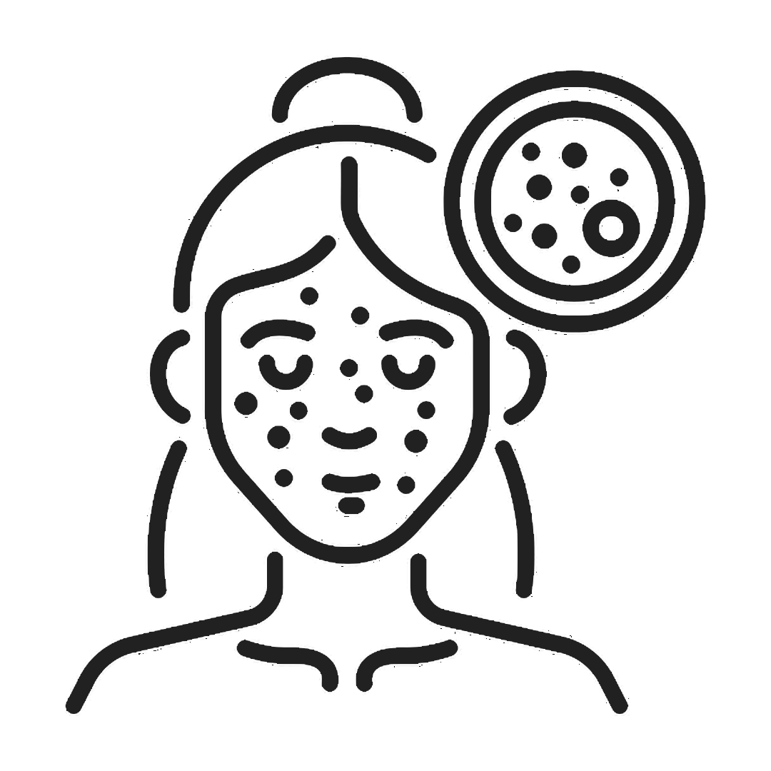 Acne Icon