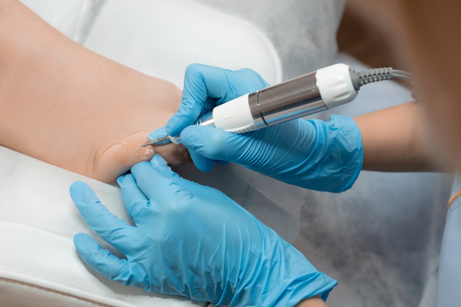 Video about Tattoo Removal